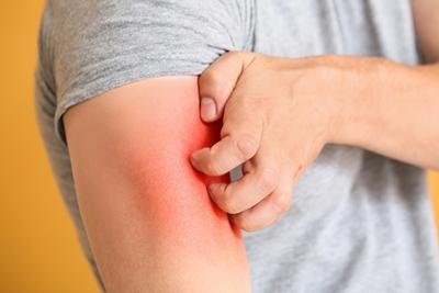 Are You Dealing with a Rash?
