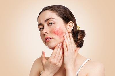 Common Skin Conditions: Eczema, Psoriasis, and Rosacea Explained