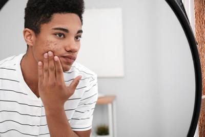Common Skin Conditions