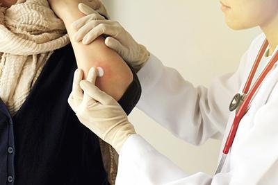 Managing Chronic Skin Conditions