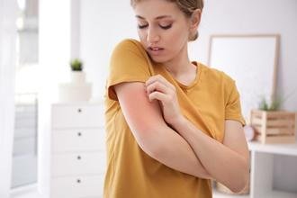 Treating Different Types of Rashes