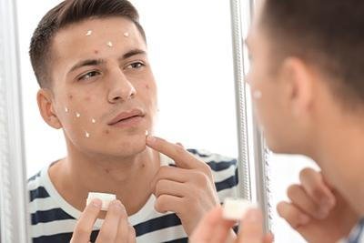 Understanding Acne: Causes and Treatment Options