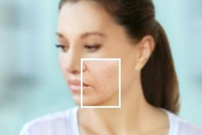 Understanding Changes in Skin Health Over Time