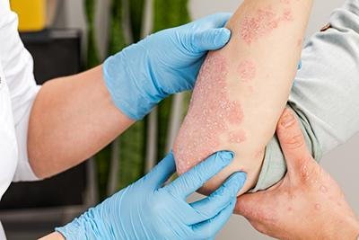 Understanding Common Skin Conditions and How to Manage Them