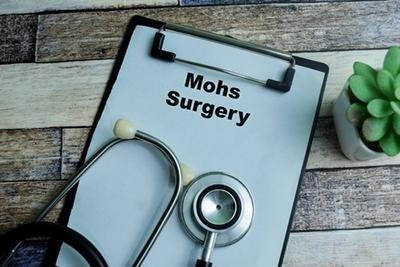 What Is Mohs Surgery?