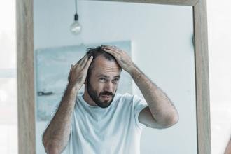 What You Need To Know About Alopecia
